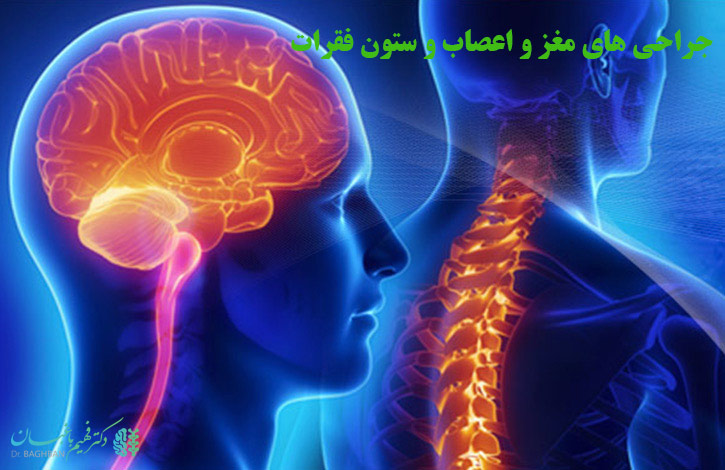 جراحی های مغز و اعصاب و ستون فقرات