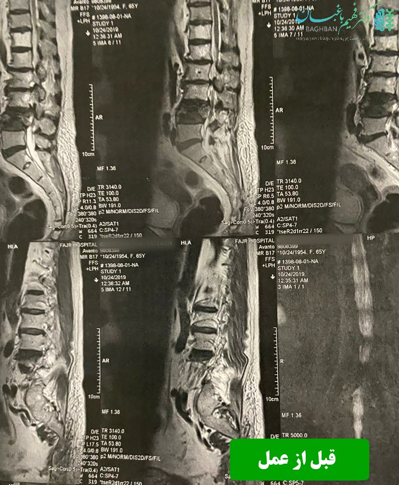 قبل از عمل جراحی