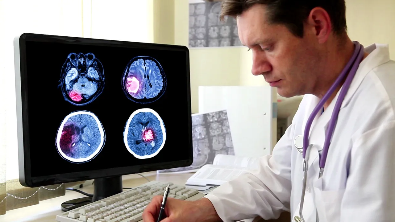 چه زمانی برای تومور مغزی به پزشک مراجعه کنیم؟