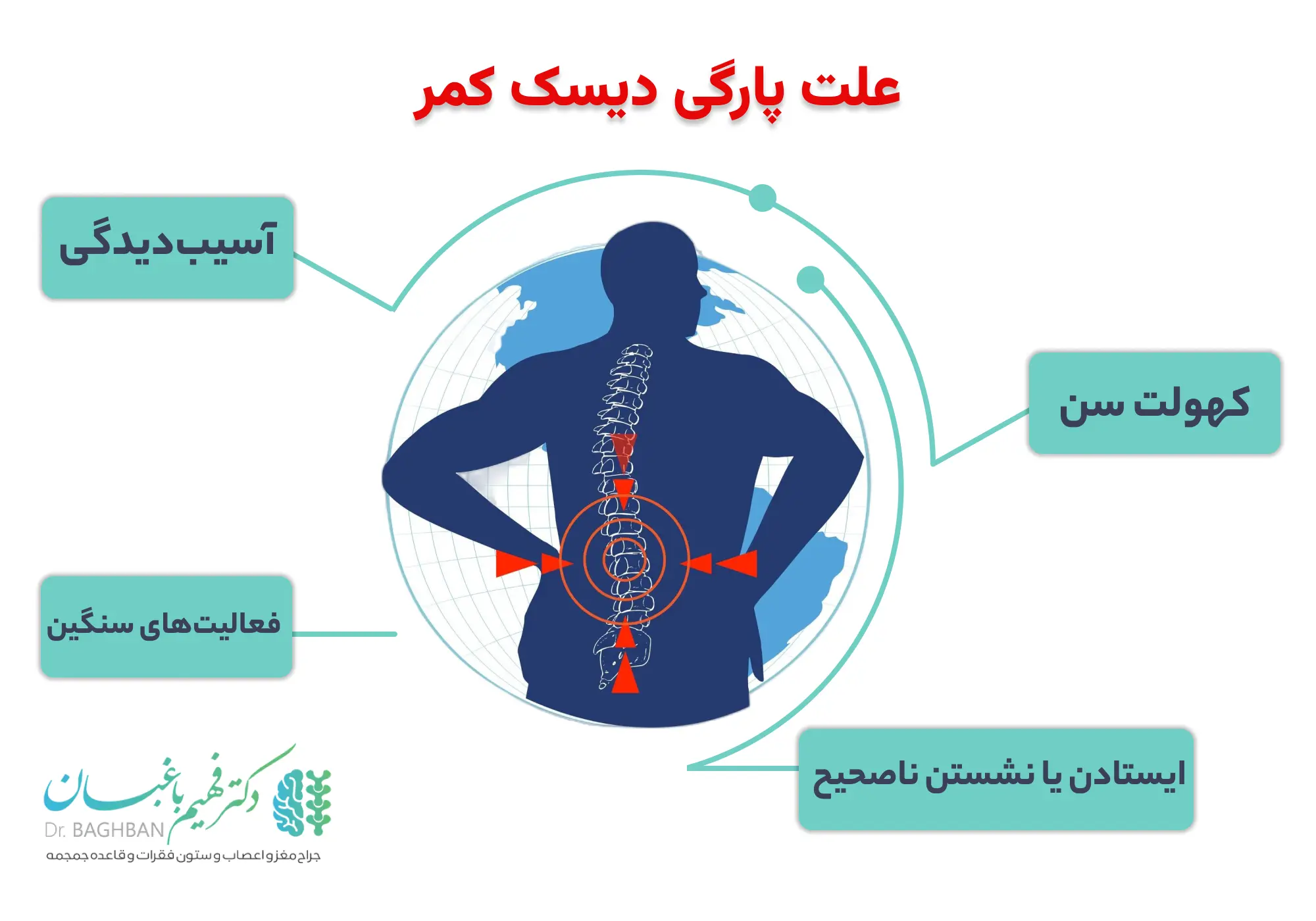 علت پارگی دیسک کمر