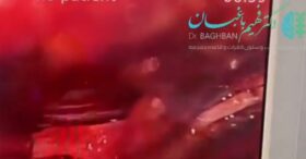 کیست سینوویال ستون فقرات