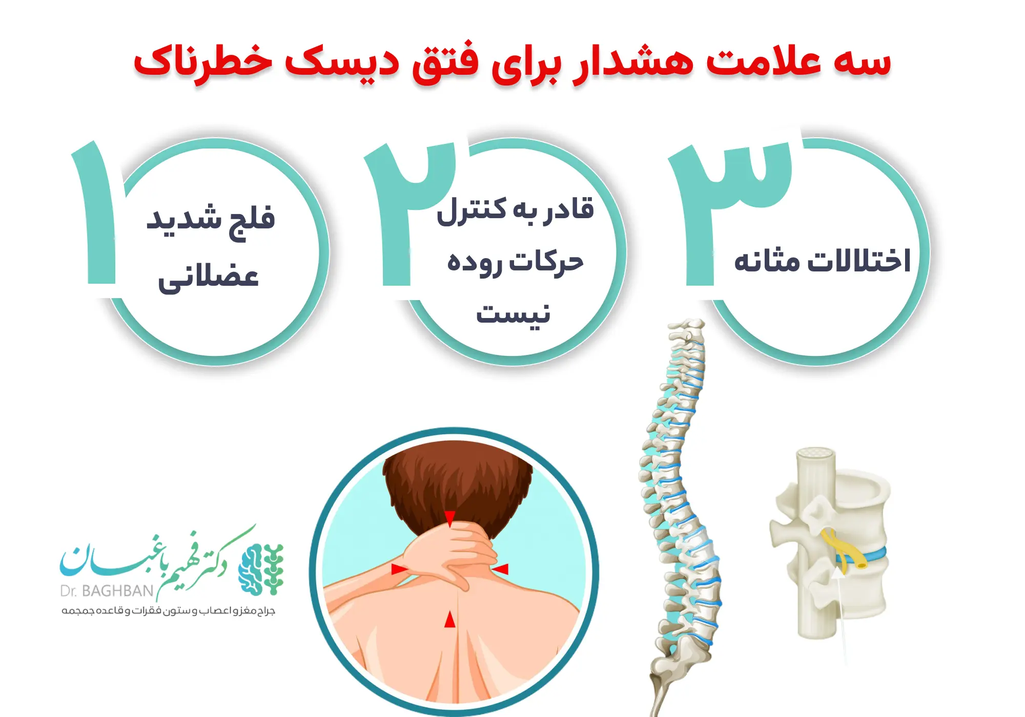 سه علامت هشدار برای فتق دیسک خطرناک