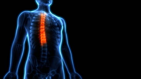 دیسک کمر و گردن چه علائمی دارد؟