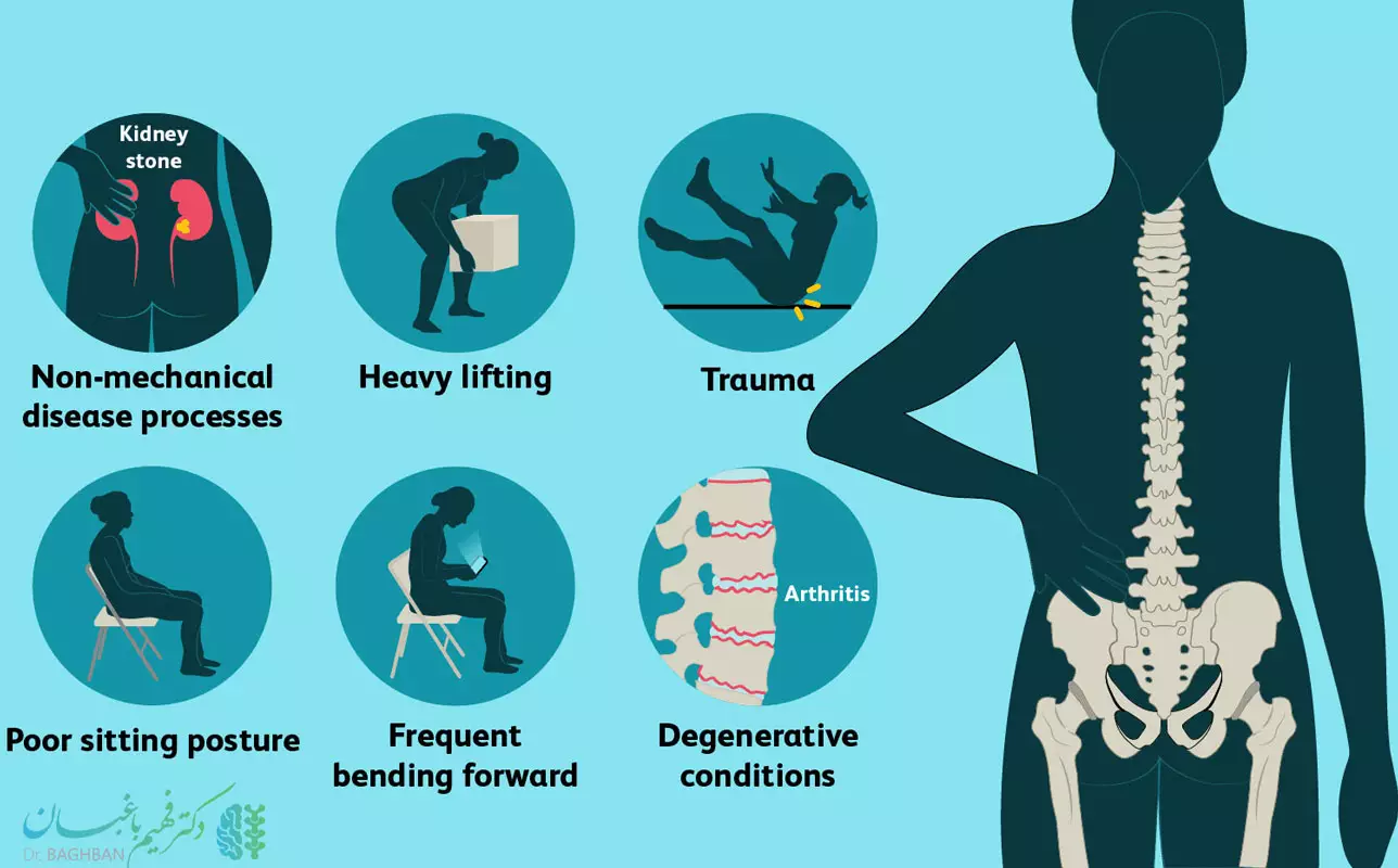 علت کمردرد در زنان و مردان
